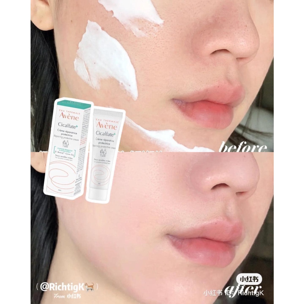 Kem Liền Sẹo Làm Mờ Vết Thâm Avene Cicalfate Creme Reparatrice