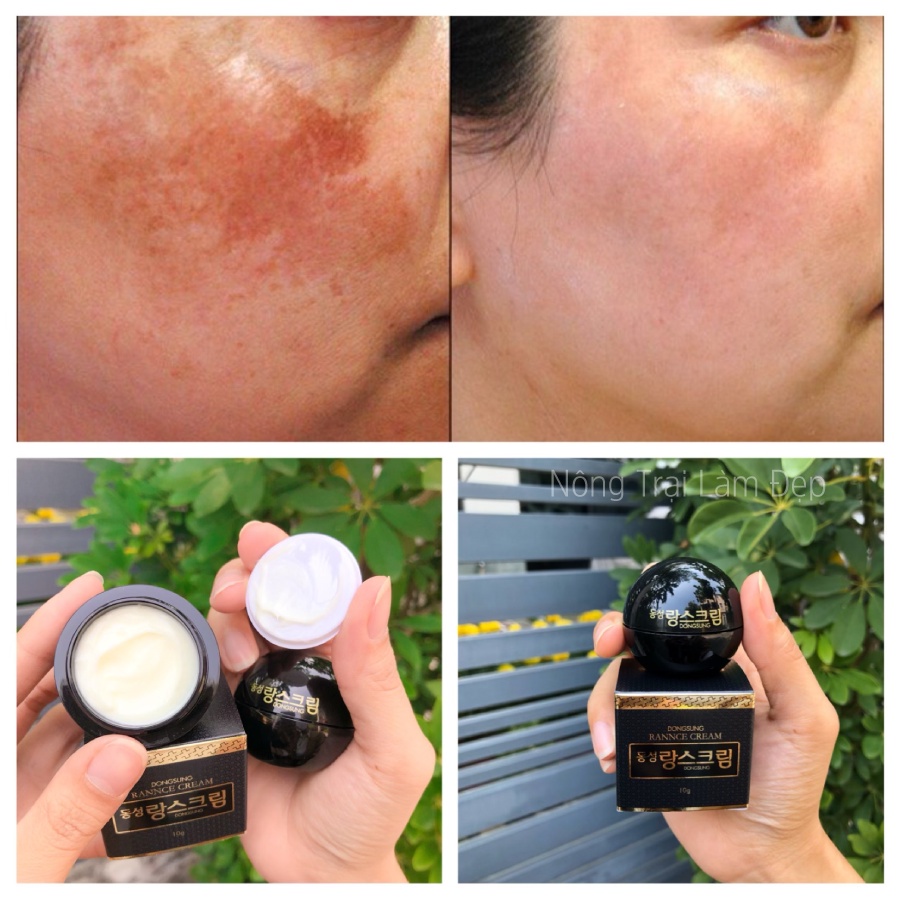 Kem Giảm Nám Và Dưỡng Trắng Dongsung Mini 10g