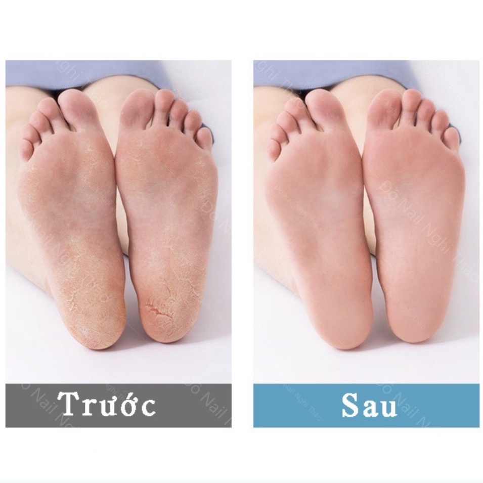 Máy Chà Gót Chân, Cà Sạch Da Thừa Dưới Gót Chân Chính Hãng Bảo Hành 12 Tháng.