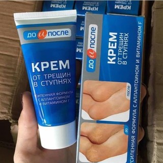 . Kem loại bỏ nứt gót chân Nga làm mềm gót chân 5.0 lttn