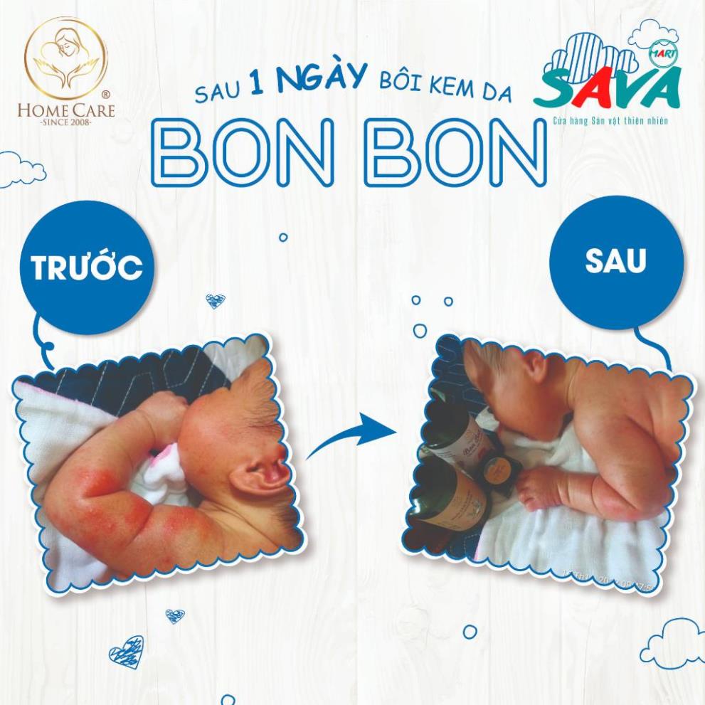 Kem Chống Hăm Em Bé Bon Bon  An Toàn Cho Bé - Giảm Ngay Hăm Ngứa , Rôm Sảy Trên Da Bé
