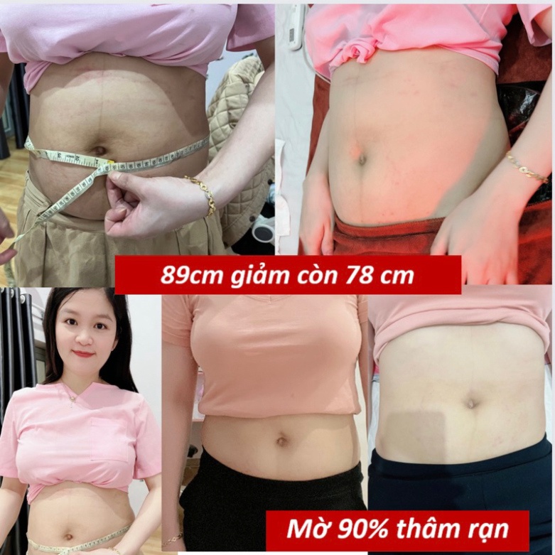 MUỐI THẢO DƯỢC CHƯỜM BỤNG SAU SINH GIẢM MỠ THỪA GIÚP VÒNG EO THON GỌN SAU SINH .