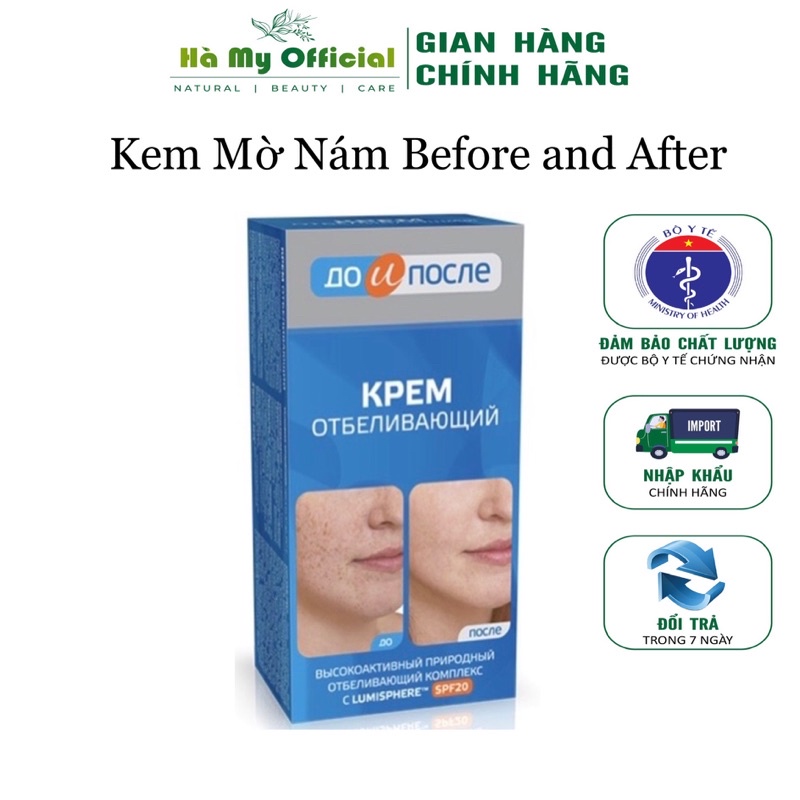 Kem mờ nám xóa tàn nhang phục hồi dưỡng ẩm chống lão hóa dưỡng da trắng sáng đều màu Before and After