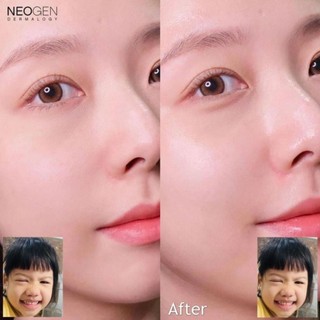 Toner Pad Rau Má Phục Hồi Da Nhạy Cảm Neogen Dermalogy Calming Cica Tree Pad 90 Miếng