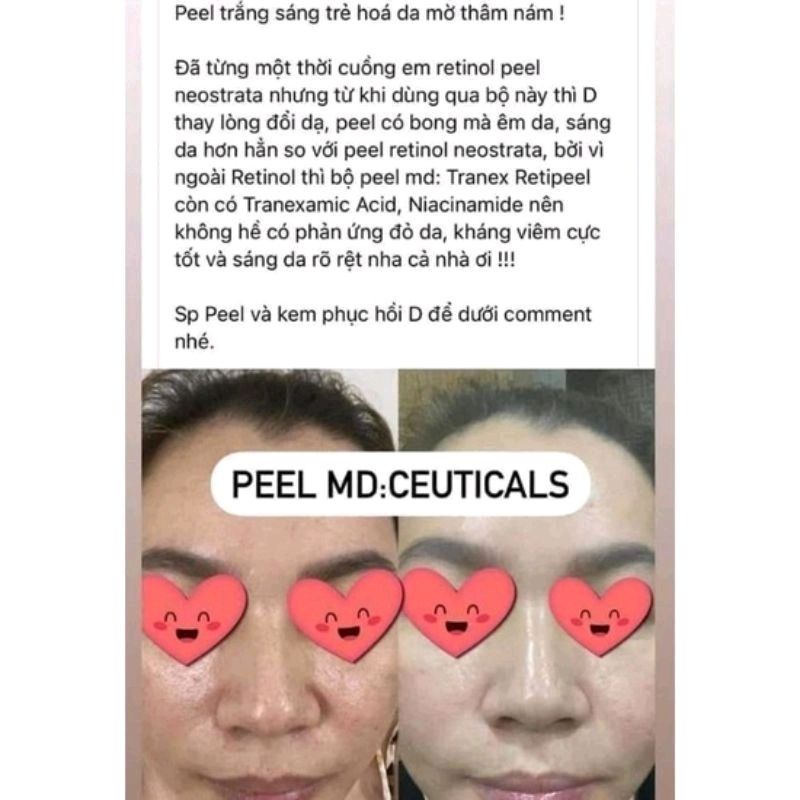 Peel Da Sinh Học Làm Sáng Da, Tái Tạo Chống Lão Hóa MD Ceutical 2ml