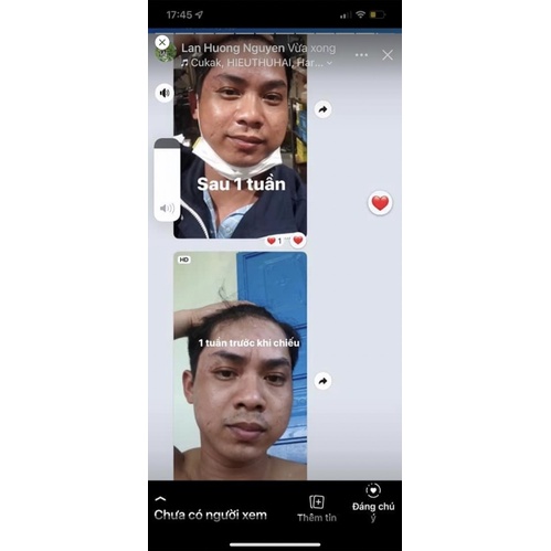 Thảo dược bôi bạch biến