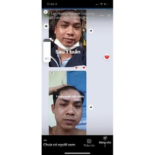 thảo dược bôi bạch biến