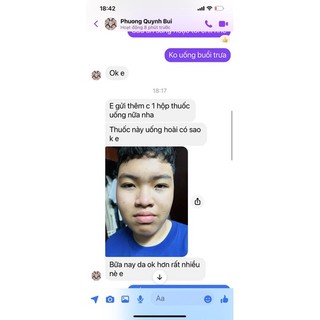 thảo dược bôi bạch biến