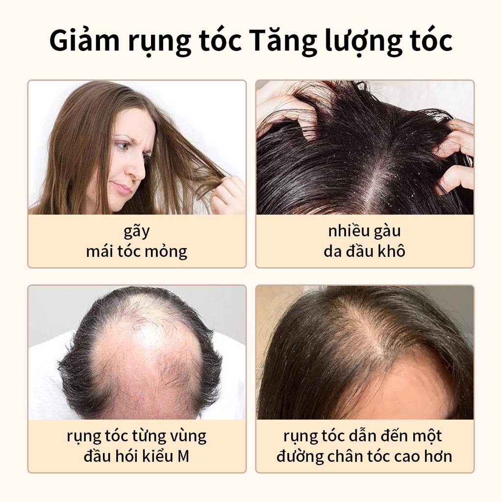 Dầu gội nhân sâm AISASEA sạch gàu giảm rụng kích thích mọc tóc 300ml