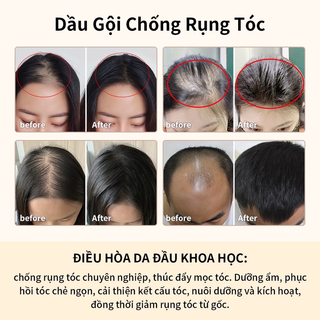 Dầu gội nhân sâm AISASEA sạch gàu giảm rụng kích thích mọc tóc 300ml