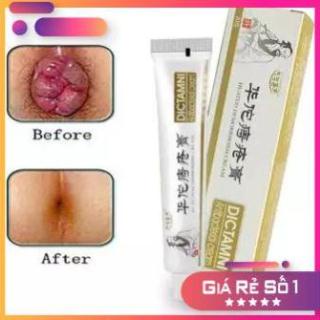 Kem bôi trĩ ngoài da nứt kẽ hậu môn dictamni 20gr