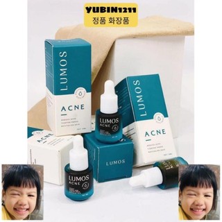 [candate] Serum Mụn Lumos Acne 5ml