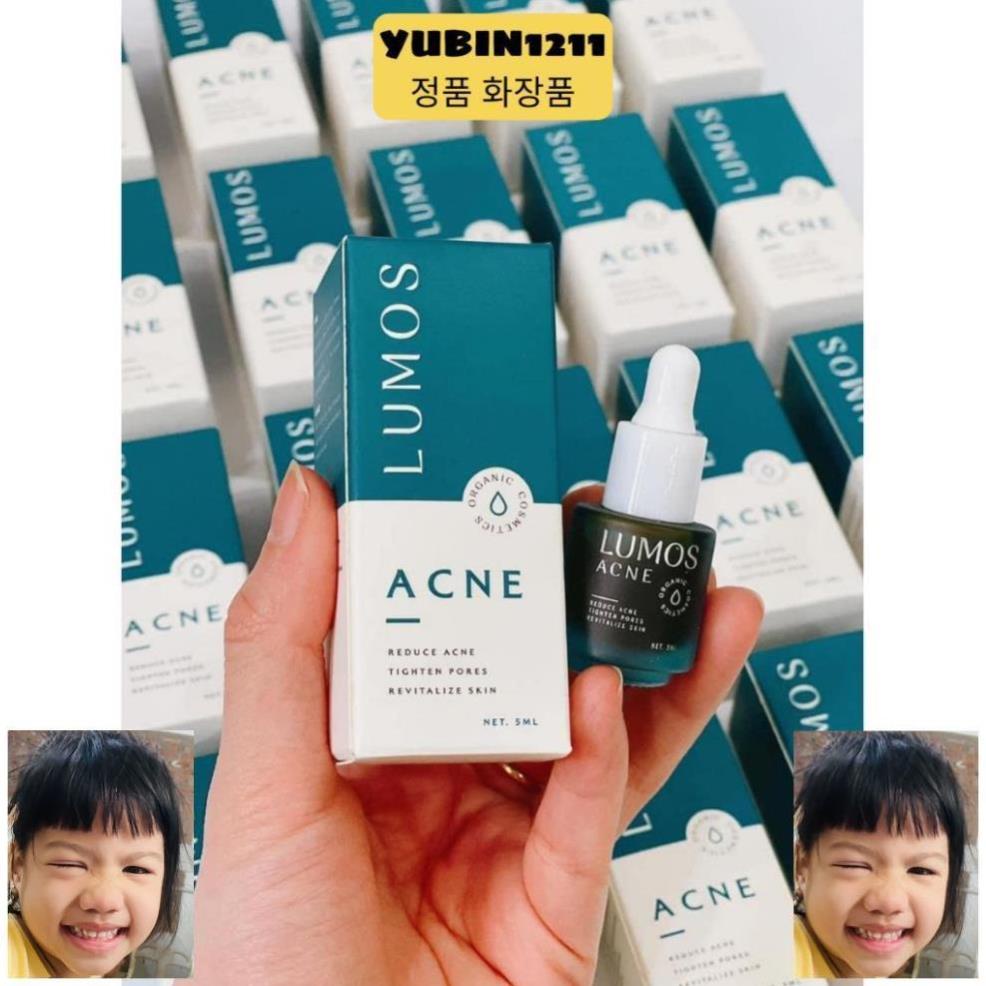 [candate] Serum Mụn Lumos Acne 5ml