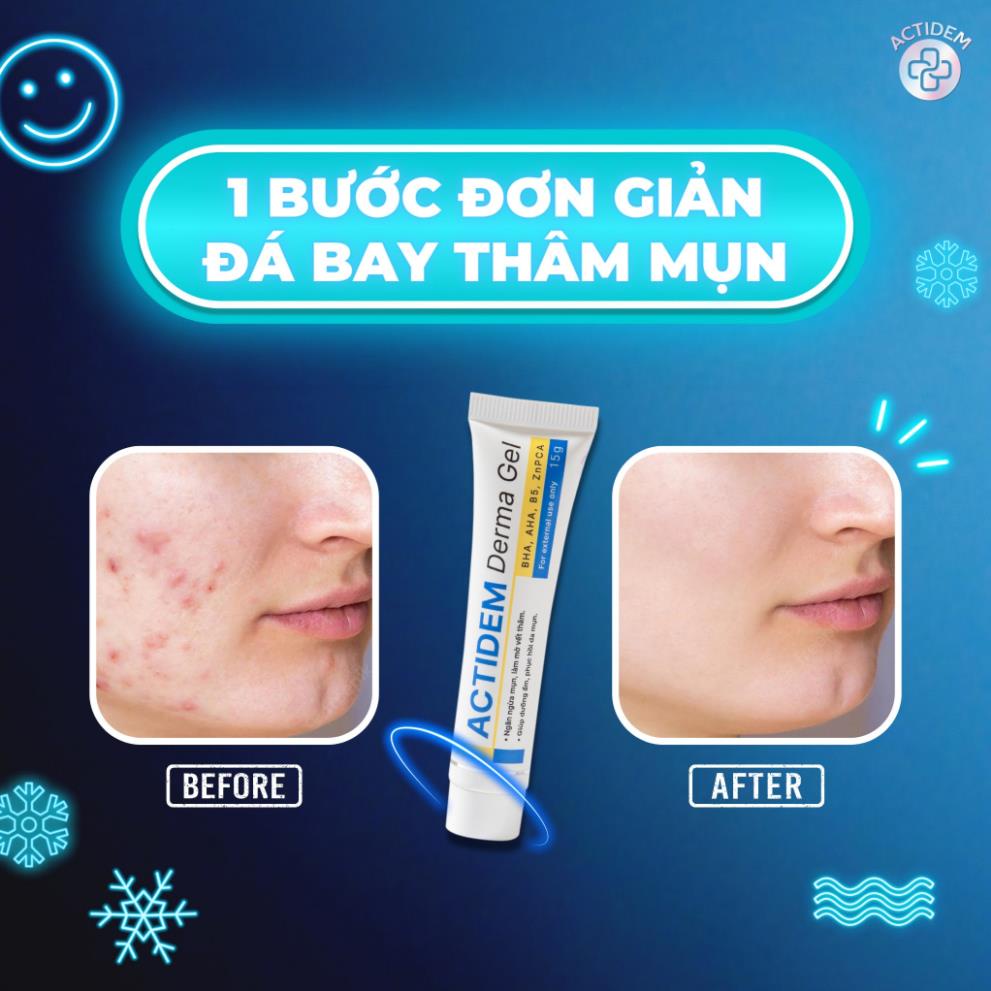 Actidem Derma Gel giảm mụn mờ thâm mụn ngăn ngừa mụn tái phát 18/40 gram