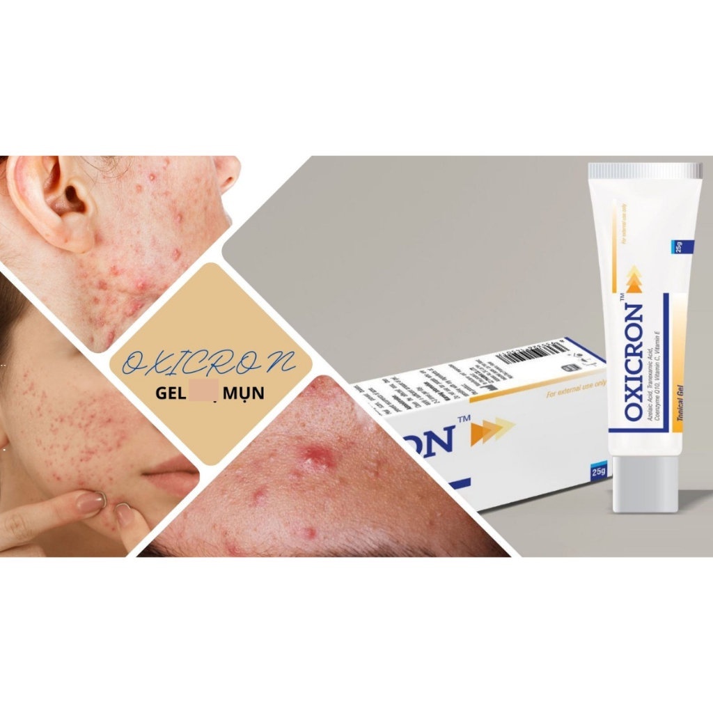 Gel bôi mụn Oxicron - làm giảm sưng viêm, giảm mụn đỏ, hạn chế tạo sẹo và thâm sau mụn, chứa azelaic 20%, tranexamic 3%