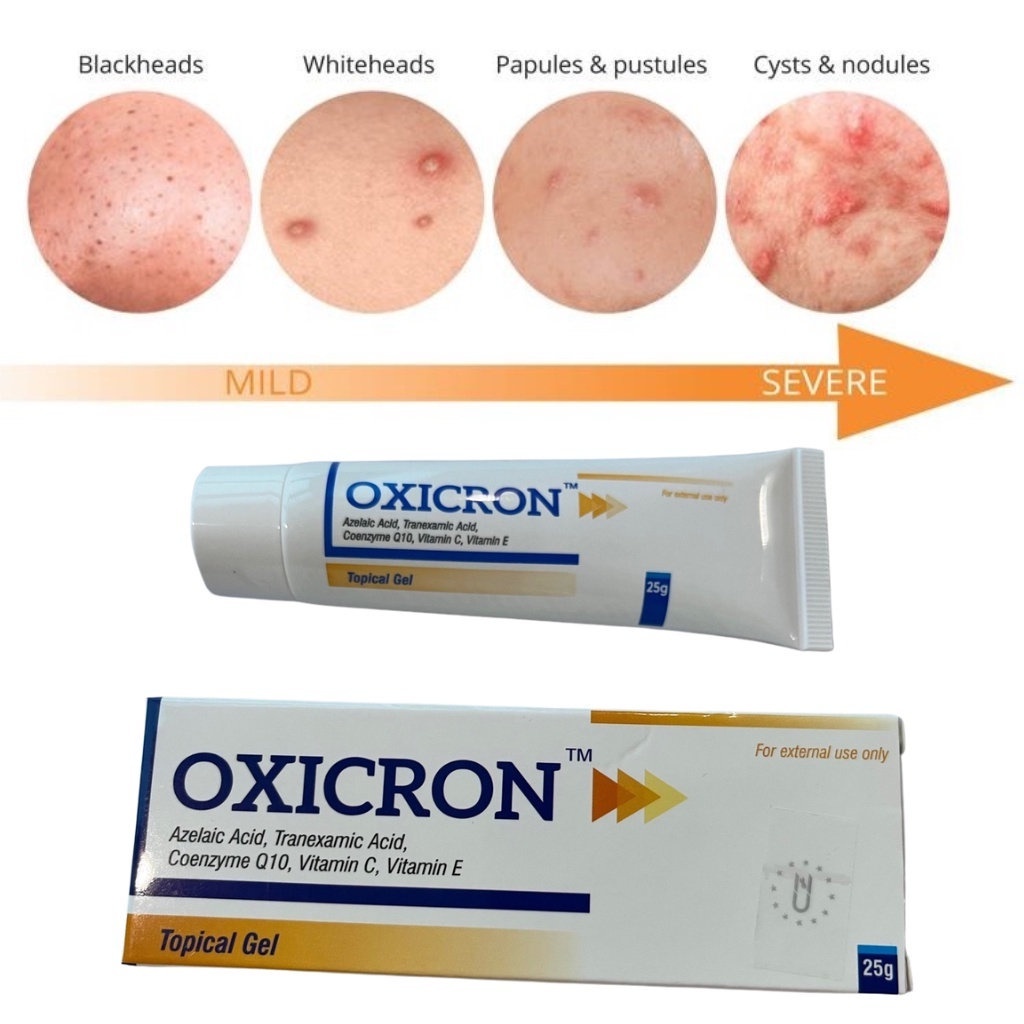 Gel bôi mụn Oxicron - làm giảm sưng viêm, giảm mụn đỏ, hạn chế tạo sẹo và thâm sau mụn, chứa azelaic 20%, tranexamic 3%