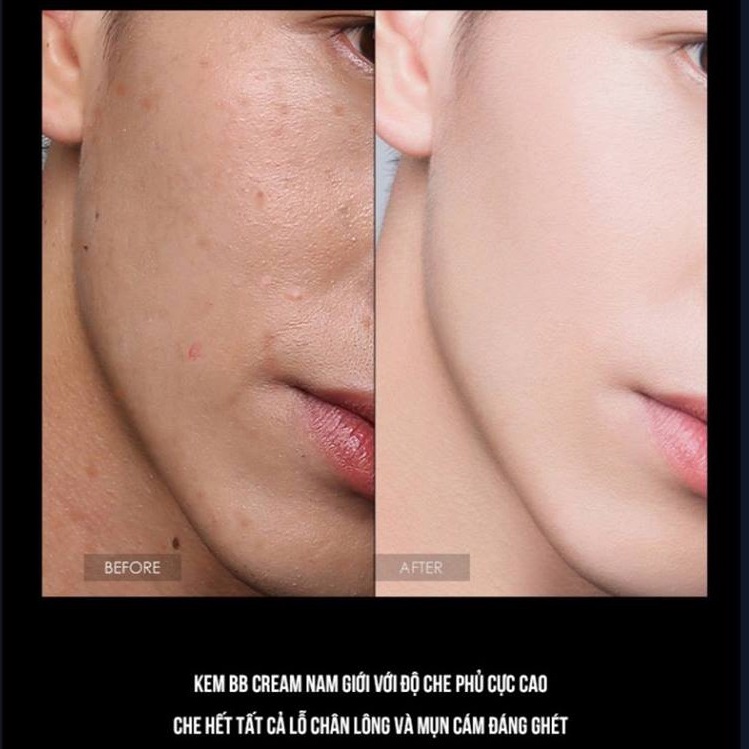 Kem Che Khuyết Điểm Nam Giới BB Cream Makeup Làm Trắng Da Che Mụn Thâm Sẹo - Kem Che Hình Xăm  - Hudu Cosmetics