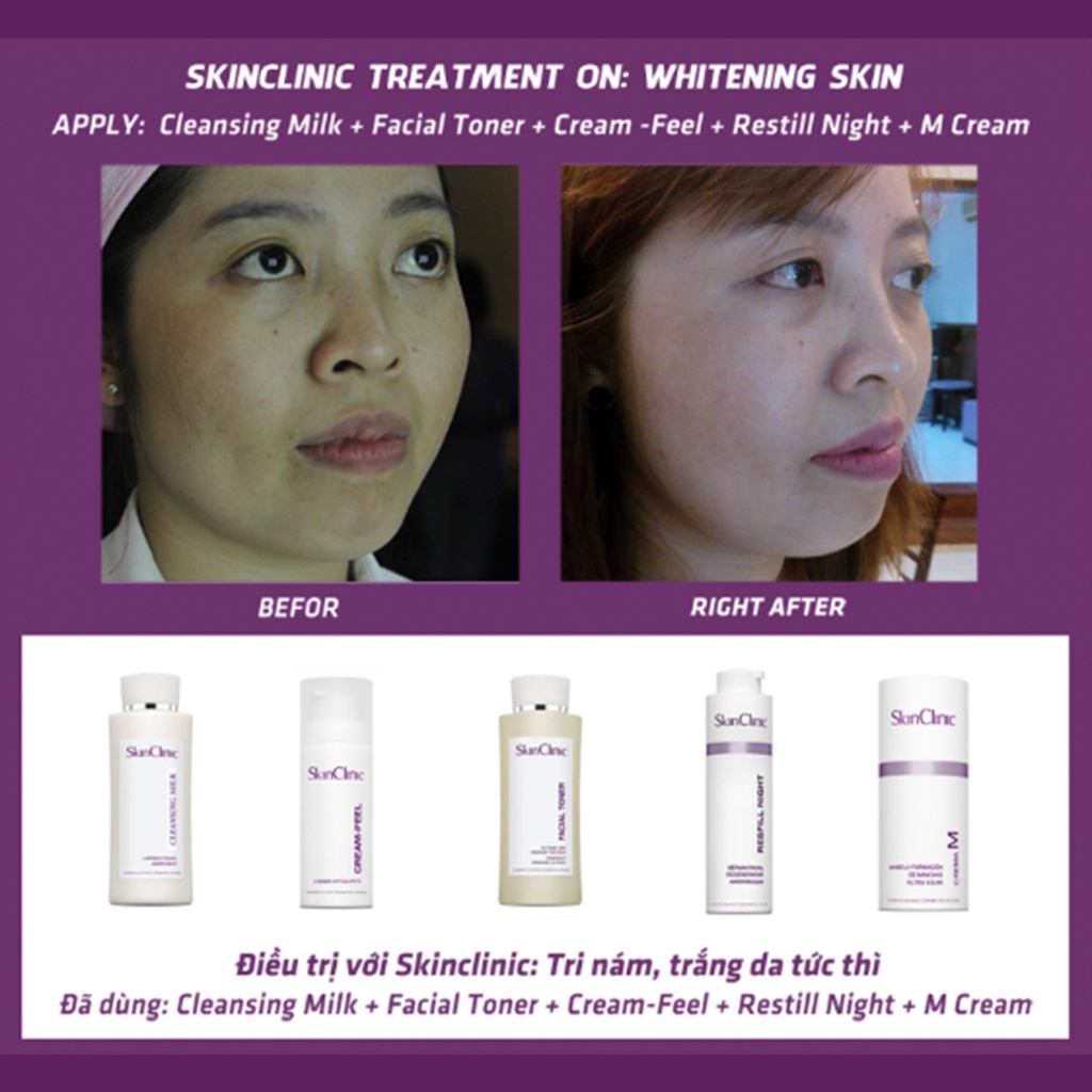 Sữa rửa mặt Skinclinic FOAM CLEANSER 50ML