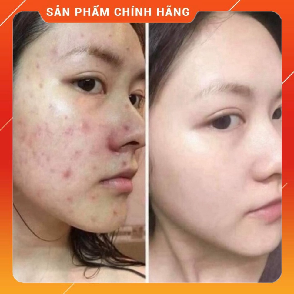 CHÍNH HÃNG -  Bộ Hoàng Cung Cam 5in1 chính hãng tặng 3 mặt nạ và 1 bộ thử.