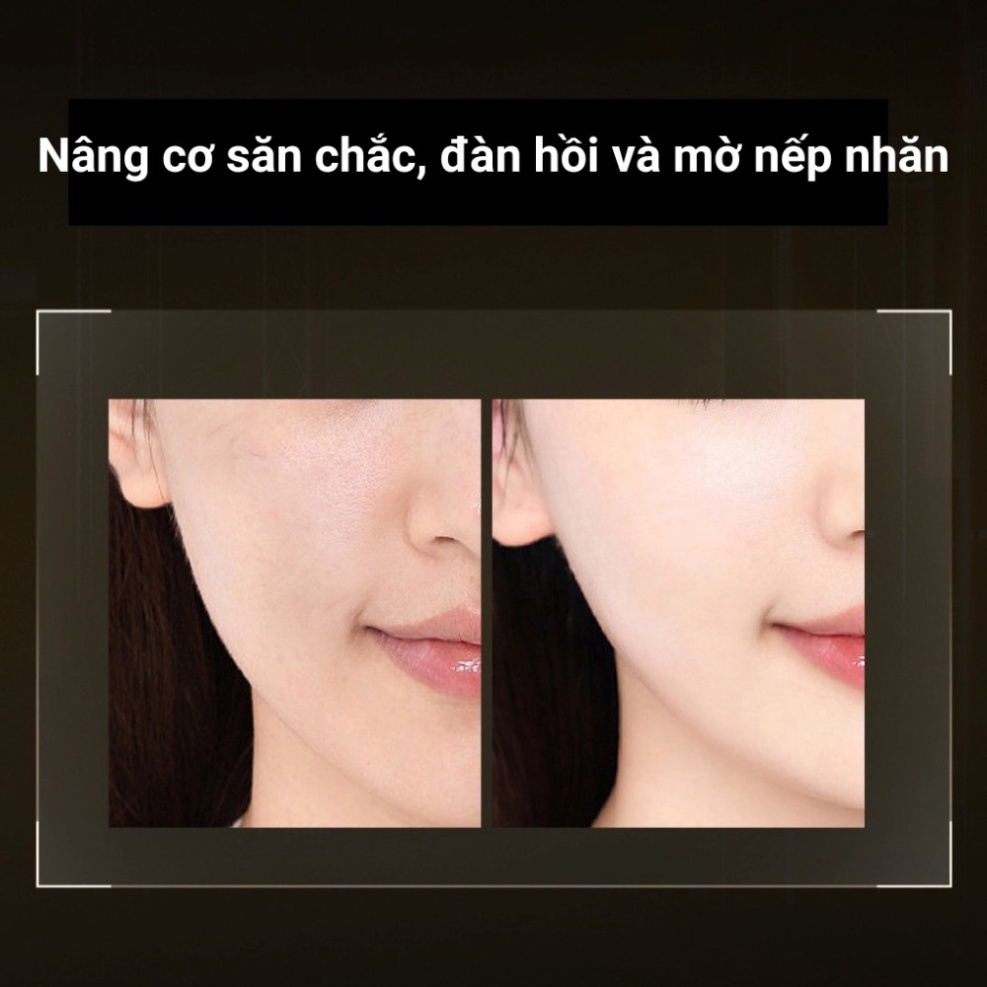 Máy massage mặt ADAD, máy nâng cơ mặt giảm nếp nhăn giúp da săn chắc thon gọn - bảo hành 12 tháng