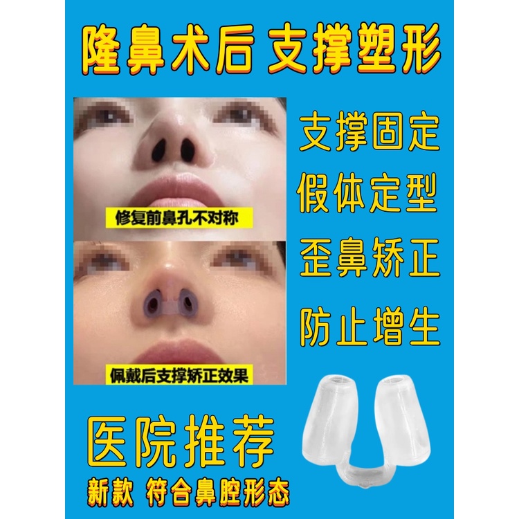 Kẹp mũi nâng mũi toàn diện hỗ trợ lỗ mũi sau phẫu thuật để ngăn ngừa tăng sản mũi lệch vách ngăn mũi