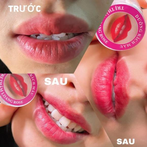 👈👉DƯỠNG KÍCH MÀU THÂM LOANG ROSE CHÍNH HÃNG👈👉 - Phun Xăm Linh Bống