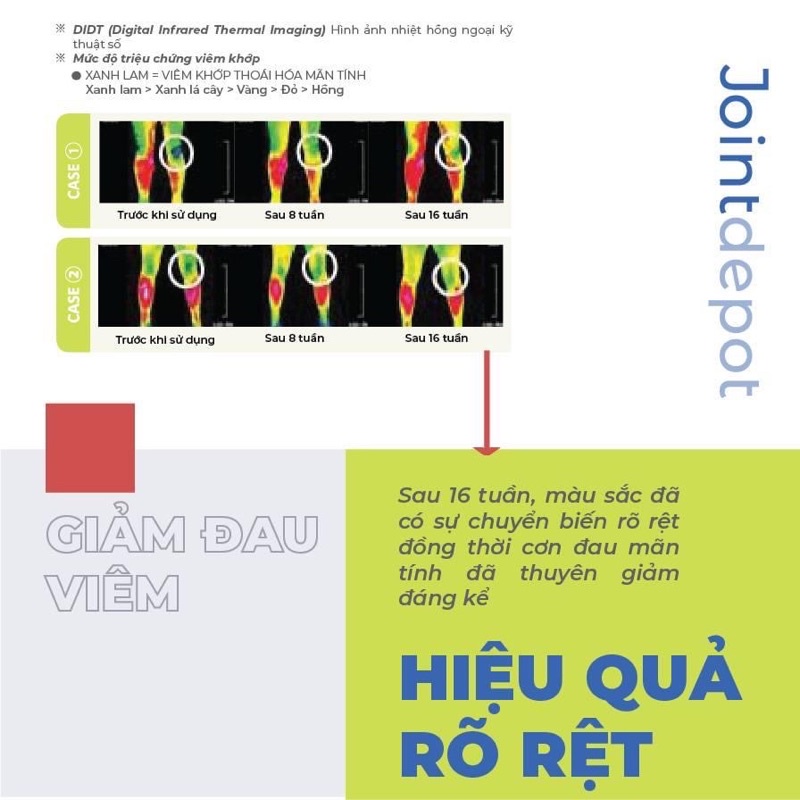 Jointdepot viên xương khớp hỗ trợ giảm đau, thoái hóa khớp - Hộp 40 viên Medimap Joint Depot