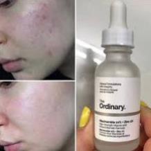 The Ordinary Niacinamide 10% + Zinc 1% Giảm Thâm Giảm Mụn Tái Tạo Da