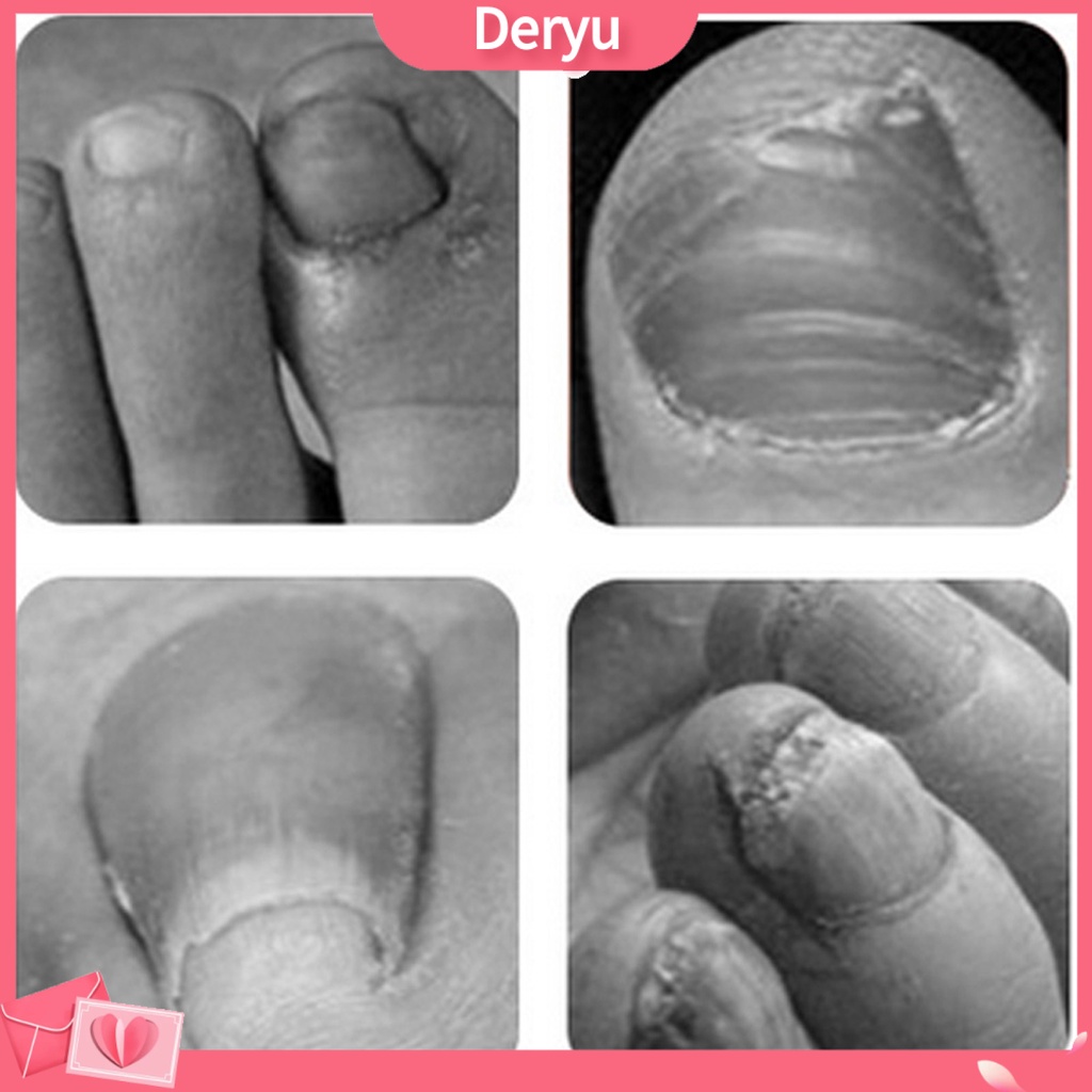 Kềm Cắt Móng Mini Bằng Thép Không Gỉ