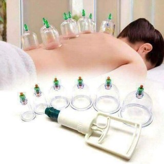 Bộ giác hơi 12 ống không dùng lửa tđ12