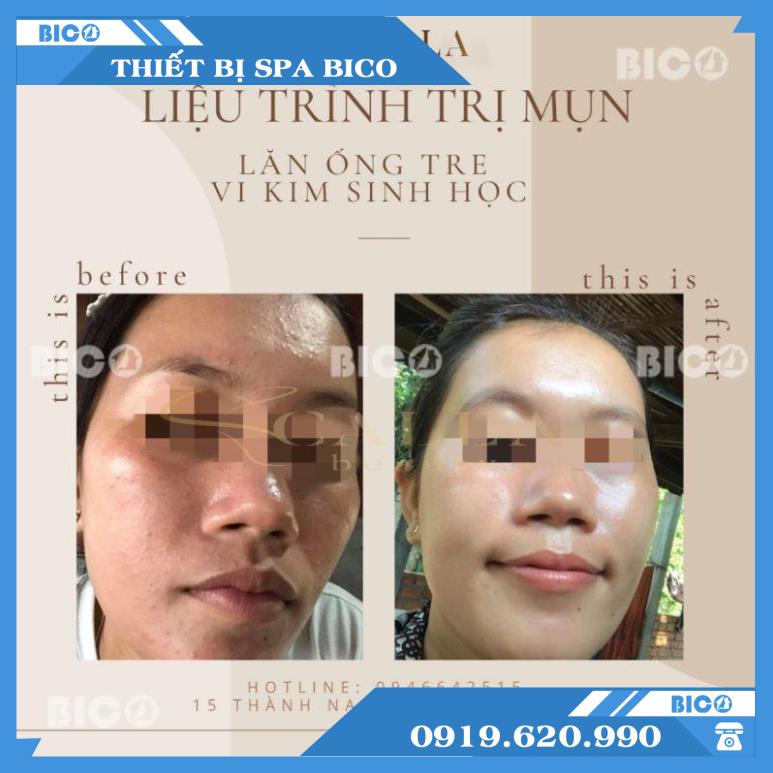 Bộ Sản Phẩm Căng Bóng Nano Mờ Thâm Trắng Da BICOS