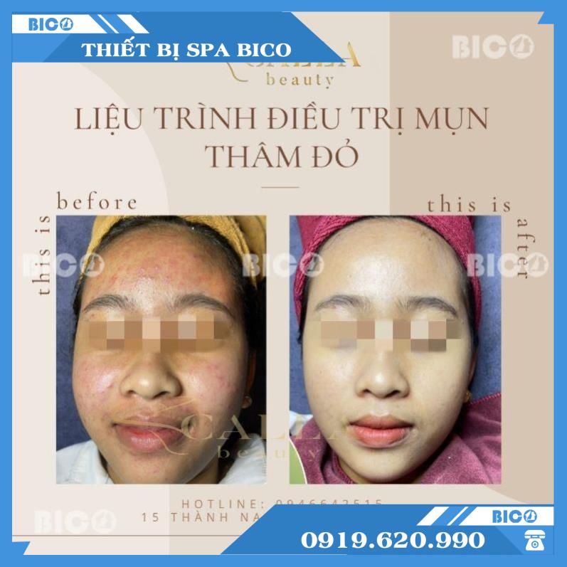 Bộ Sản Phẩm Căng Bóng Nano Mờ Thâm Trắng Da BICOS