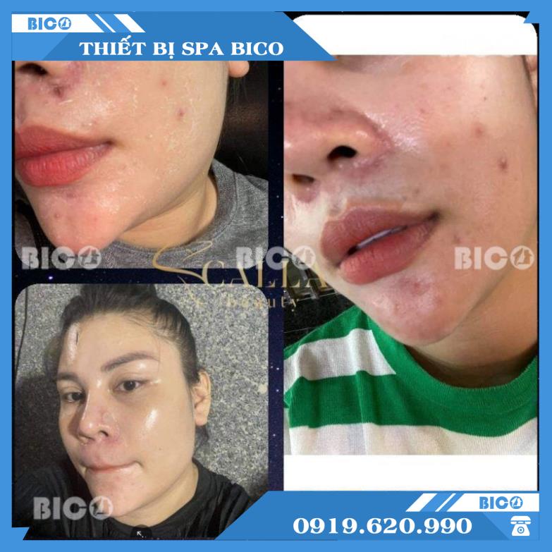 Bộ Sản Phẩm Căng Bóng Nano Mờ Thâm Trắng Da BICOS