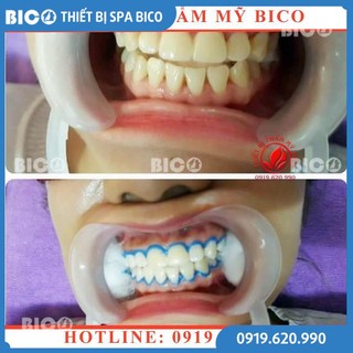 KEM BẢO VỆ NƯỚU DÙNG CHO TẨY TRẮNG RĂNG HÀNG CHÍNH HÃNG - Thiết Bị Thẩm Mỹ BICO