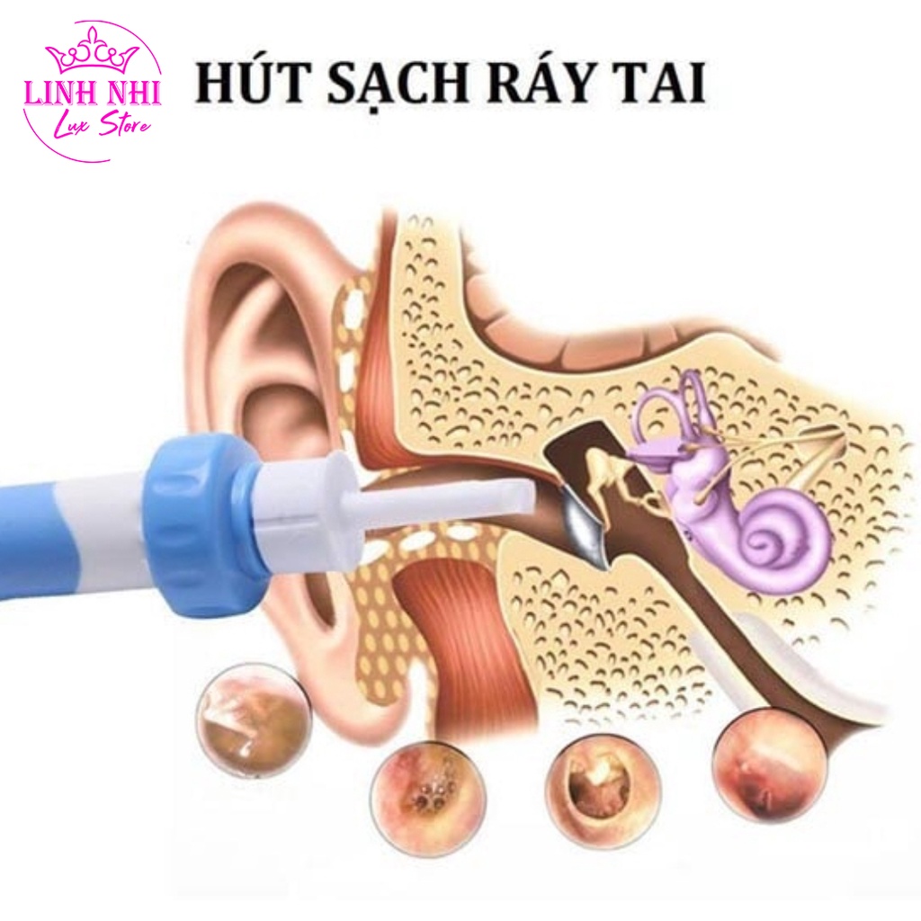 Máy Hút Ráy Tai Cho Bé - Dụng Cụ Lấy Ráy Tai Nhật Bản Tự Động An Toàn Tại Nhà - Linh Nhi Lux Store