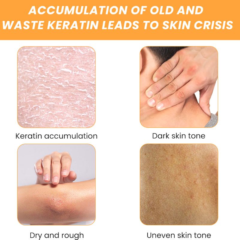 Gel tẩy tế bào chết herorange Mintox làm trắng da toàn thân làm sạch da mặt