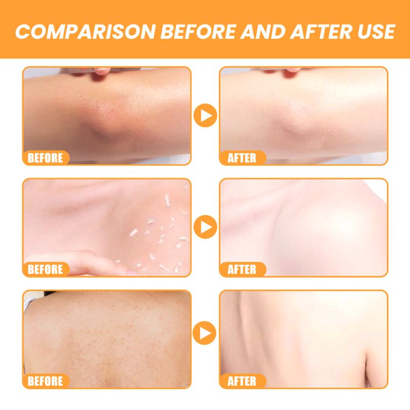 Gel tẩy tế bào chết herorange Mintox làm trắng da toàn thân làm sạch da mặt