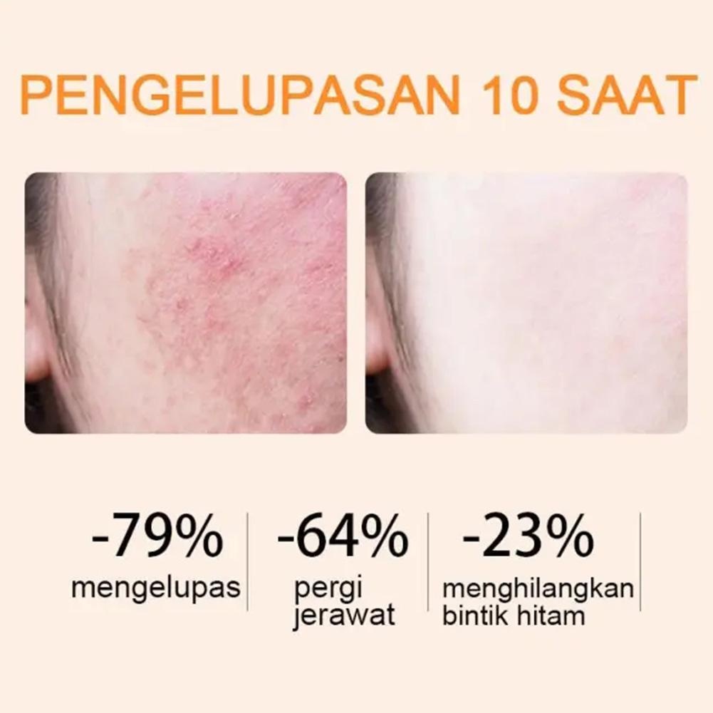 Gel tẩy tế bào chết herorange Mintox làm trắng da toàn thân làm sạch da mặt