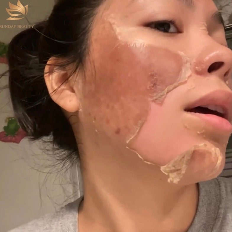 Peel da ROYCE SKIN M+ Da bong mảng to peel da làm đẹp theo xu hướng .