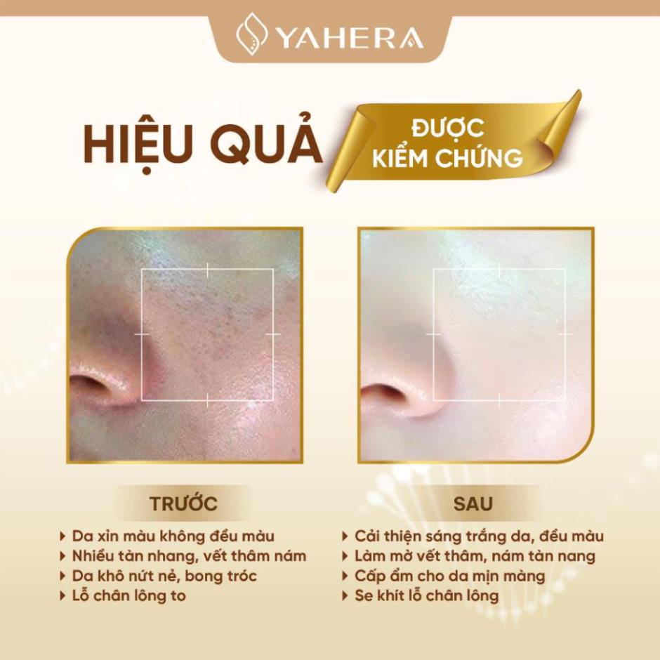 Bộ đôi dưỡng trắng ban đêm YAHERA Gồm serum dưỡng trắng 30g và kem dưỡng trắng da mặt 20g
