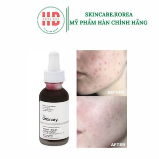 Tinh chất Tẩy da chết hóa học (Peel) The Ordinary AHA 30% + BHA 2% Peeling Solution 30ml