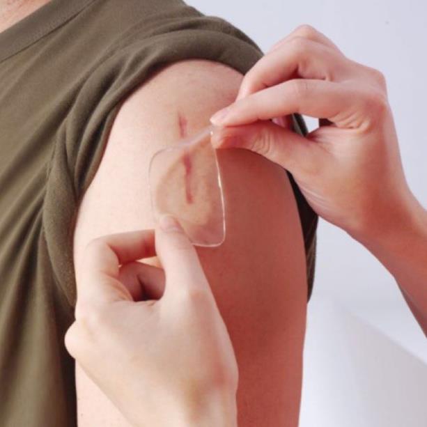 Tấm dán loại bỏ sẹo dùng cho sẹo thâm, sẹo lõm, sẹo tai nạn Scar Fx 2.5x2.5cm/ 3x10cm/10x20cm