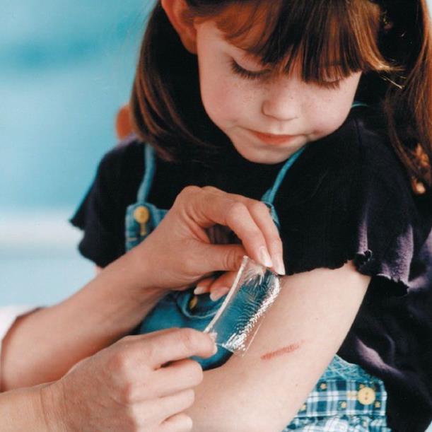 Tấm dán loại bỏ sẹo dùng cho sẹo thâm, sẹo lõm, sẹo tai nạn Scar Fx 2.5x2.5cm/ 3x10cm/10x20cm