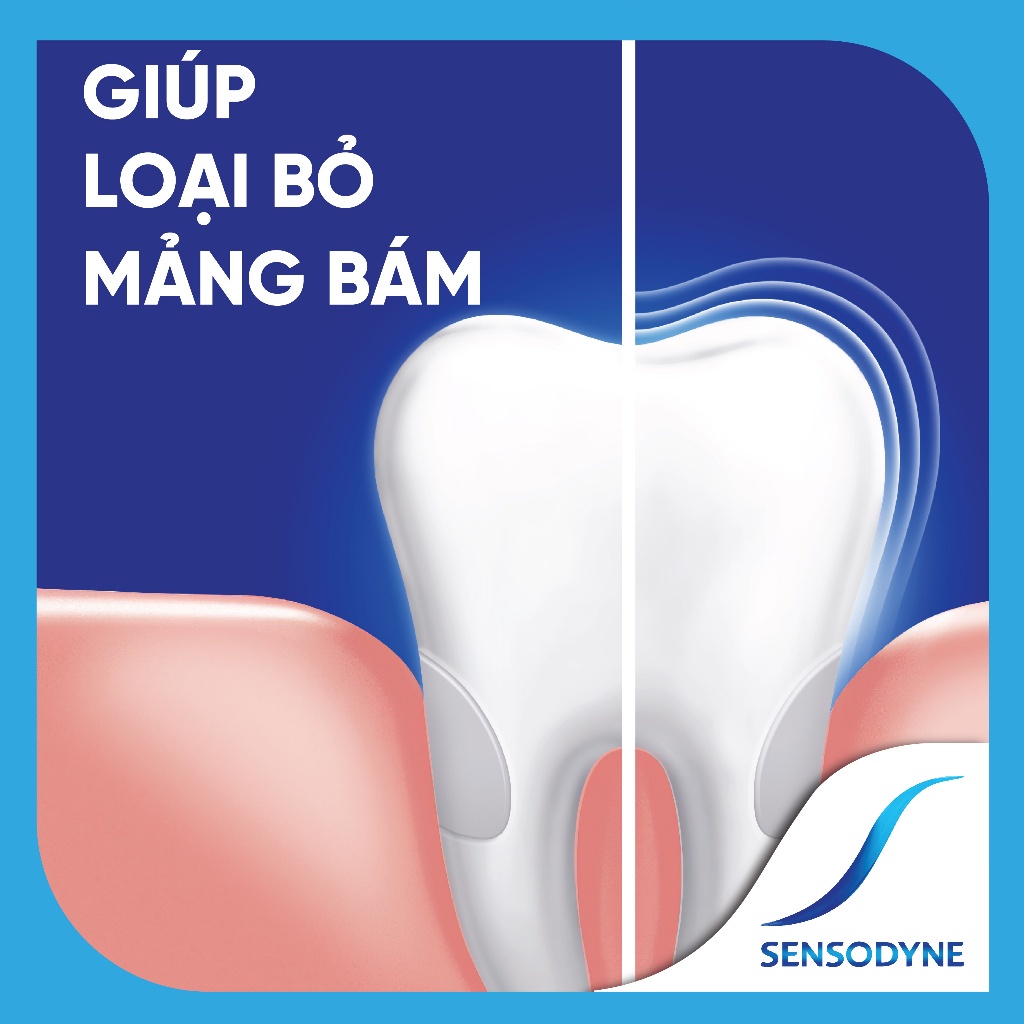 Bộ 2 Kem đánh răng SENSODYNE Gentle Whitening 160g giúp giảm ê buốt hiệu quả và làm trắng răng tự nhiên