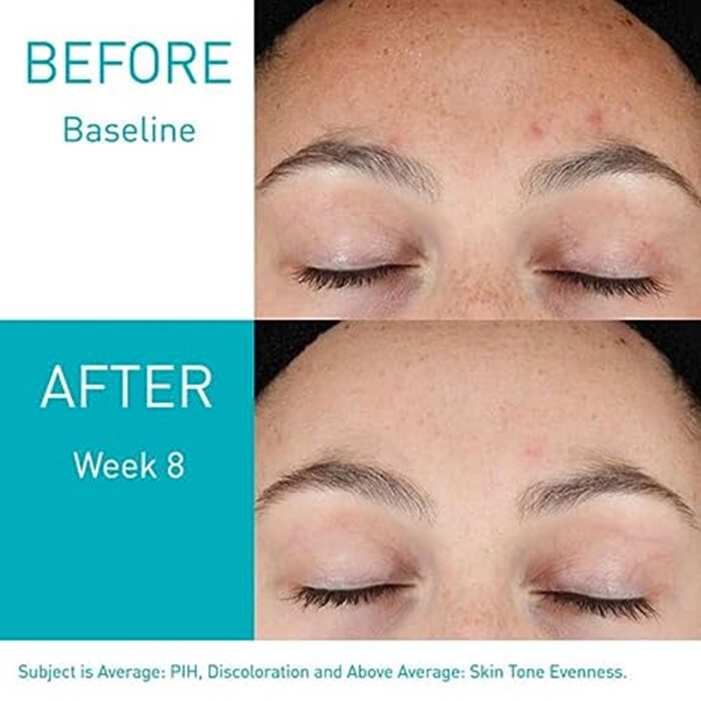 Tinh chất Cerave skin renewing & hydrating & resurfacing retinol serum 30ml