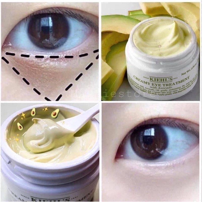 Kem Mắt Bơ Cấp Ẩm Chuyên Sâu Kiehl’s Creamy Eye Treatment with Avocado