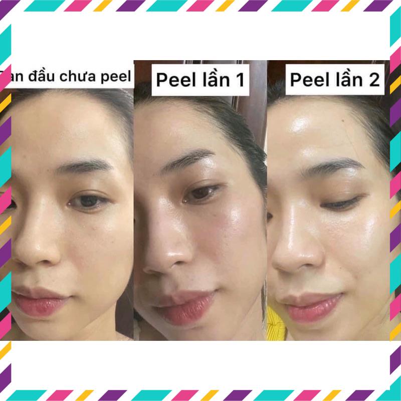 Tinh chất Peel căng bóng giảm mụn trẻ hoá da BiorePeel Cl3 6ml