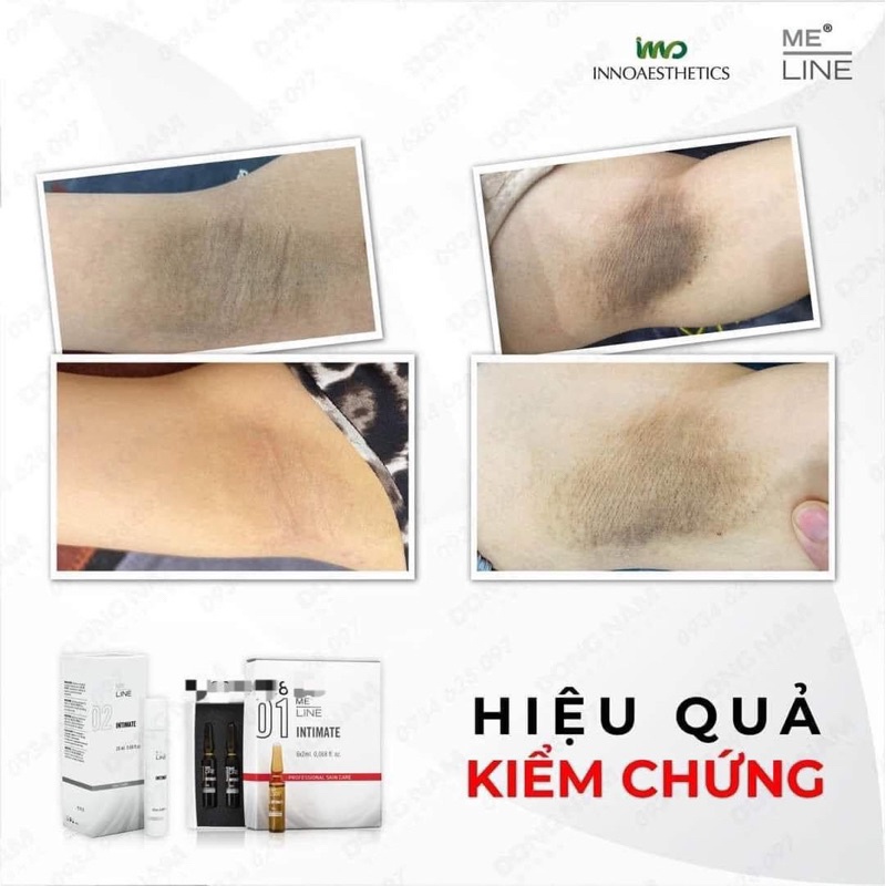 Peel giảm thâm vùng da nhạy cảm Innoaesthetics - 01 MELINE INTIMATE