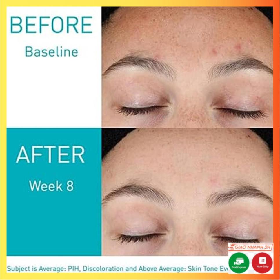 Tinh chất Cerave skin renewing & hydrating & resurfacing retinol serum 30ml - DORIS