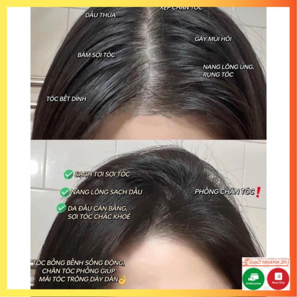 Combo Dầu Gội Và Dầu Xả Nhân Sâm Đỏ X6 Dr Di Hi Chính Hãng  - DORIS